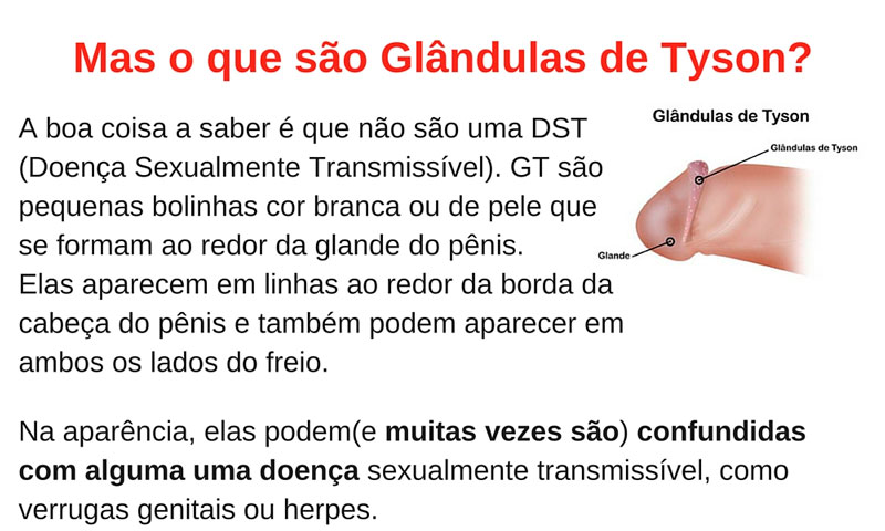Glândulas de Tyson
